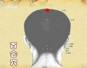 治疗头痛的穴位:百会穴