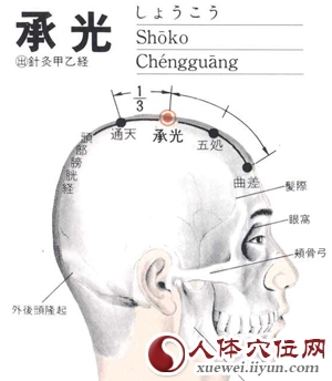 承光穴