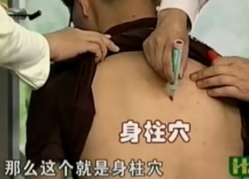 治疗咳嗽的第一穴位:身柱穴