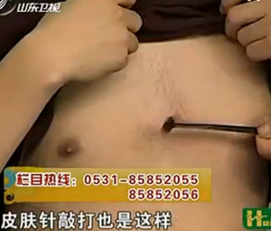 治疗心绞痛的穴位:膻中穴