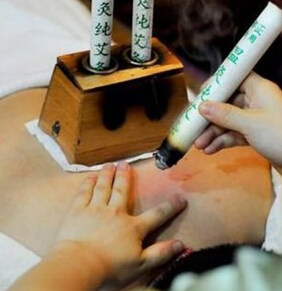 艾灸注意事项:灸伤处理及灸后反应