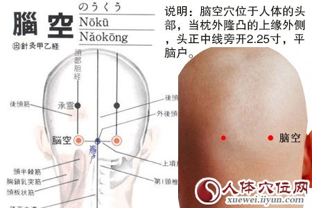 脑空穴