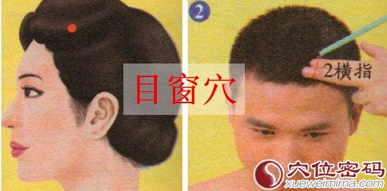 目窗穴的取穴方法示范图