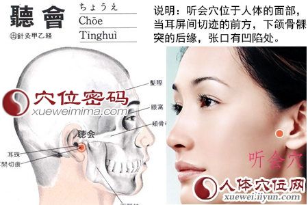 听会穴位位置图