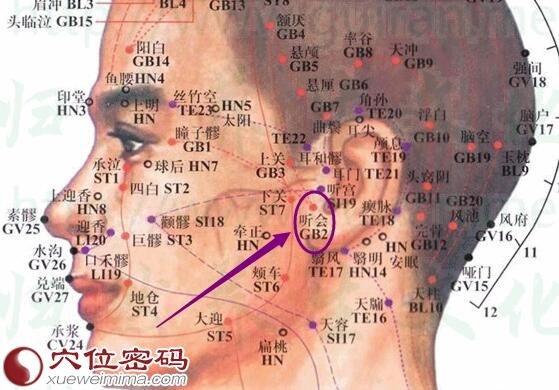 听会穴的准确位置图