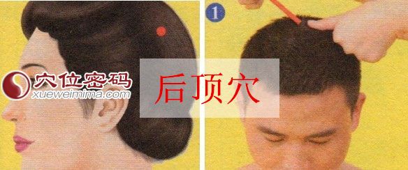 后顶穴的位置图