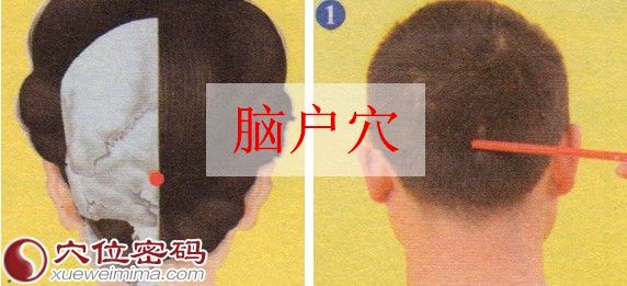 脑户穴的位置图