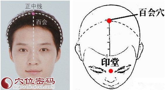 图解百会穴的准确位置图