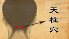 颈项僵硬按天柱穴