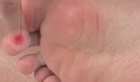 按摩独阴穴缓解治疗胃痛