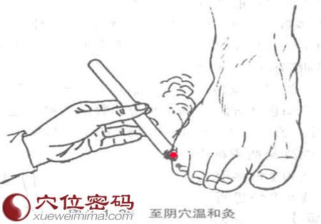 艾灸至阴穴