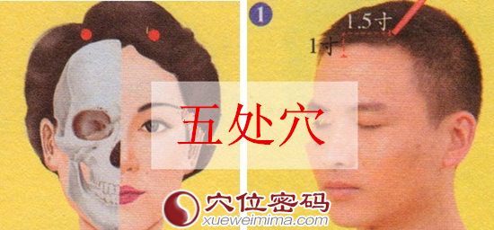 五处穴的准确位置图