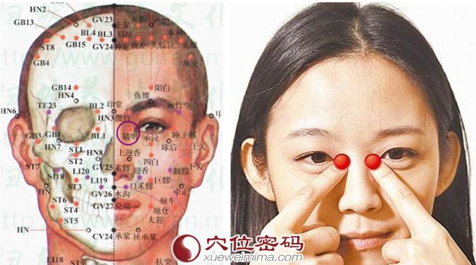 睛明穴的位置及解剖分析图