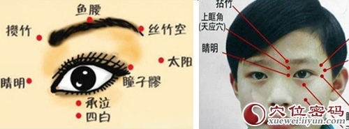 睛明穴位位置图