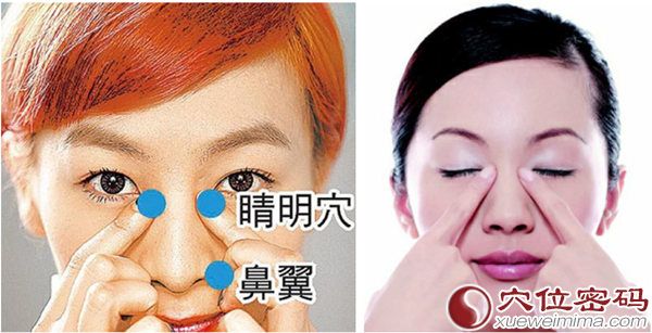 睛明穴位图