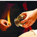 拔罐治病又强身健体 盘点拔罐时的注意事项　