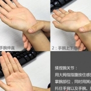 鼠标手怎么治 简单六步骤点穴防治