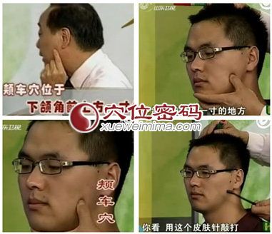 颊车穴的准确位置